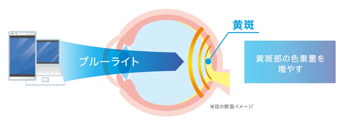 ブルーライト